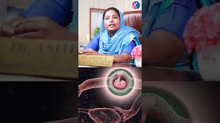 Pregnancy After Family Planning Operation?| கருக்குழாய் இணைப்பு | Dr Ashika