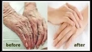 HOW TO MAKE YOUR HANDS LIKE BABY SKIN WRINKLES GONE