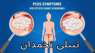 تنبلی تخمدان | واقعا تنبلی تخمدان درمان میشه؟!