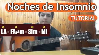 [TUTORIAL] Airbag - Noches de Insomnio