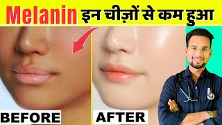 How to reduce melanin in skin naturally | Melanin kam karne ke upay | How to increase melanin | Skin