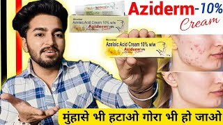 Aziderm Cream | Aziderm Cream Review | Aziderm Cream Side Effects