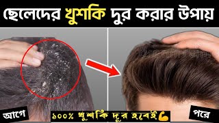 ছেলেদের খুশকি দূর করার ৫ টিপস 🔥 Bangladeshi Men Dandruff Solution | খুশকি দূর করার শ্যাম্পু