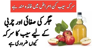 Benifits Of Apple Cider Vinegar In Urdu | Sirka Saib Ke Fayde | Fatty Liver Treatment