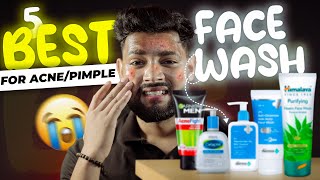 Top 5 Best FACE WASH for Acne Prone Skin