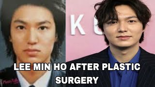 LEE MIN HO AFTER PLASTIC SURGERY| NOSE JOB | PREZ TV