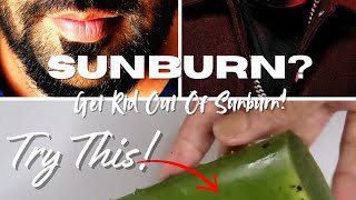 How to Heal Sunburn Fast at Home | #SunburnRemedy #SkincareTips #NaturalRemedies