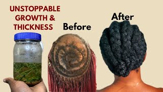 Regrow bald spots and edges with this treatment #simplychisom #naturalhair #hairgrowthremedy