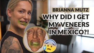 EVERYTHING YOU NEED TO KNOW BEFORE GETTING VENEERS IN MEXICO! 😨😱 - Pt. 1