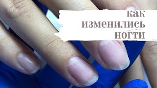 Как изменились ногти | Комбинированный маникюр | Цвет Тиффани