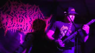 Fetal Embalment at Denver Deathfest