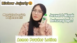 RIVIEW ACNES POWDER LOTION PEMAKAIAN 1 BULAN -  BIKIN KAGET SIH