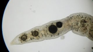 Stenostomum leucops