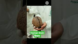 human brain real image