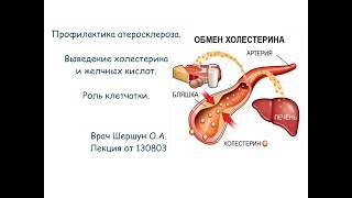 130803 Профилактика атеросклероза. Выведение холестерина и желчных кислот. Врач Шершун Ольга