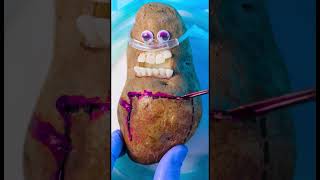 Potato attacked by Creeper while birthing Tator Tot 😭🥔💔🪦🥺#DiscountDentist Ep 247 #FruitSurgery