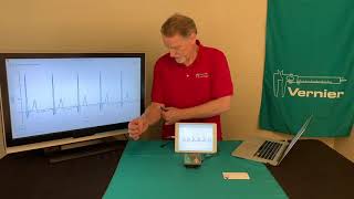 Monitoring EKG