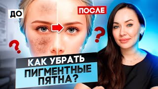 Как убрать пигментные пятна с лица? Ответ опытного косметолога.