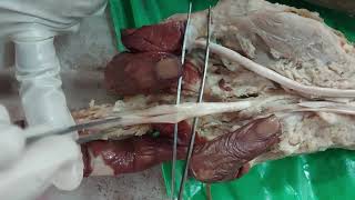 Dissection: Flexor Muscles of Forearm