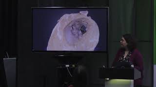 Claudia Krebs - Photogrammetry in the Human Body