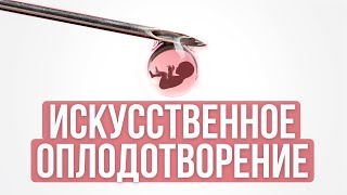 Разрешено ли искусственное оплодотворение (эко)?