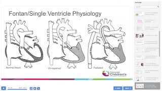 How to perform Cardiopulmonary Exercise Testing in Congenital Heart Disease ?