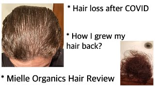 Hair loss after COVID | Mielle Organics Hair REVIEW | Grow your hair back