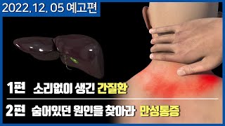 [메디컬다큐365] 소리없이 생긴 간질환 / 숨어있던 원인을 찾아라 만성통증 (22.12.05 예고편)