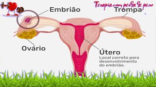 Saúde -   Gravidez ectópica: o que é, sintomas, tratamento e riscos