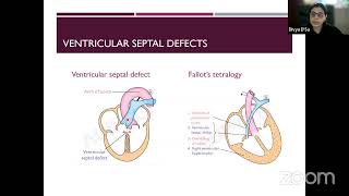 45 Days To MBBS Finals Intensive Revision Series Anatomy Live Class about  Embryology 2 Dr. Divya