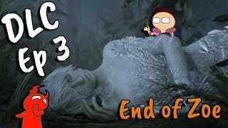 RE7 - End of Zoe - Ep 3 - The Ole' Wet Hand