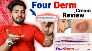 Fourderm Cream Review | Fourderm Cream Kis Kam Ati Hai