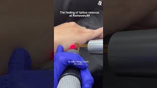 The feeling of tattoo removal at Removery👀