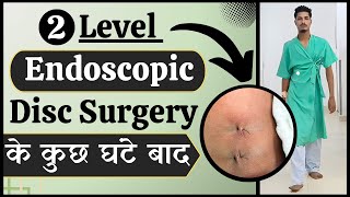 2 level Endoscopic disc surgery के कुछ घंटे बाद | Slip Disc Spine Surgery In Delhi