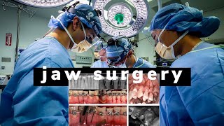 Orthognathic Surgery จัดฟันร่วมกับศัลยกรรมกระดูกขากรรไกร