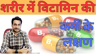 विटामिन के कमी के लक्षण | vitamin ki Kami se Hone Wali Bimari #vitamin #multivitamin