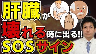 【放置厳禁】絶対見逃してはいけない肝臓が壊れる時に現れる危険サイン14選。皮膚の異常だけではなく●●も危険なので気をつけて！【がん専門医が語る】