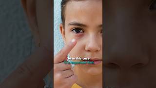 Eye Flu क्यूँ फैल रहा है ,इसका कारण क्या है ? Conjunctive Virus Spreading Why ?  -Infomance