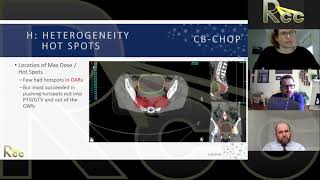 2D to 3D EBRT | Session 19 | Panel Review of Homework Assignments