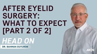 After Eyelid Surgery: What to Expect [Part 2 of 2]