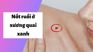 Xem bói nốt ruồi ở xương quai xanh Trái, Phải Có ý nghĩa gì? Tốt hay Xấu?