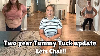 TUMMY TUCK UPDATE | -80 pounds and 2 years later! New loose skin??