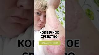 Копеечное и реально рабочее средство! Артикул WB: 67774920