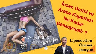 Liposuction da Sınır Nedir?  İnsan Derisi ve Araba Kaportası: Şaşırtıcı Benzerlikler!