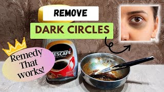 Dark Circles? No Problem. This Effective Remedy is for You🤎🍃