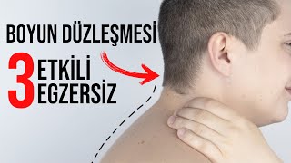 Boyun Düzleşmesi Nedir ? Evde Çok Rahat Yapabileceğiniz Boyun Düzleşmesi  Egzersizleri