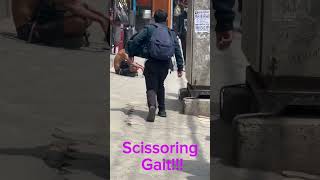 Scissoring gait!!!!!