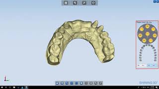 Model Scan Shining 3D Autoscan-DS-EX Dental 3D Scanner | Go3DPro.com