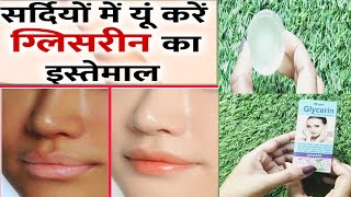 ऐसे लगाओ Glycerine बेदाग चमकती त्वचा के लिए || Use Glycerine for amazing Result - YouTube