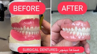 MAKING OF DENTURES 4K . صناعة دينچر بروس #WAXBAE #DENTURES